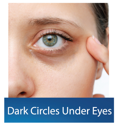 Dark-Circle-Under-Eyes treatment in Dubai