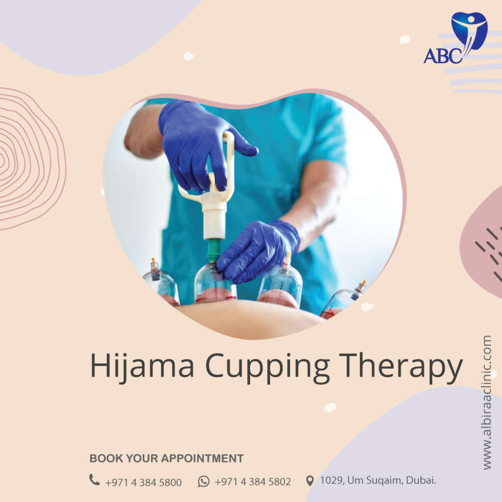 Best Hijama-Cupping-Therapy-Clinic in Dubai