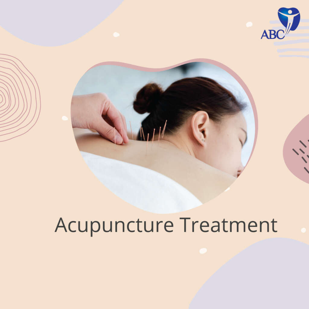 Acupuncture-Treatment-Clinic Dubai, UAE