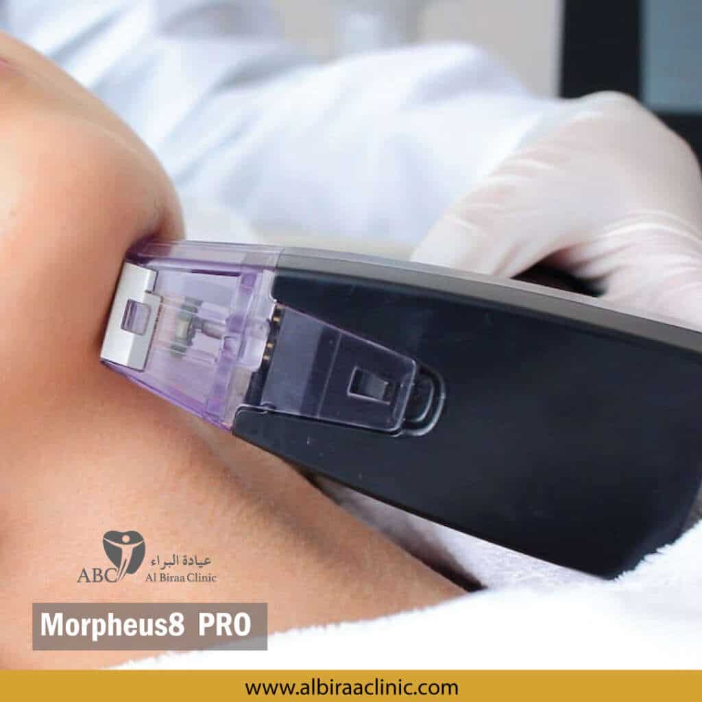 Morpheus8-pro treatment clinic Dubai