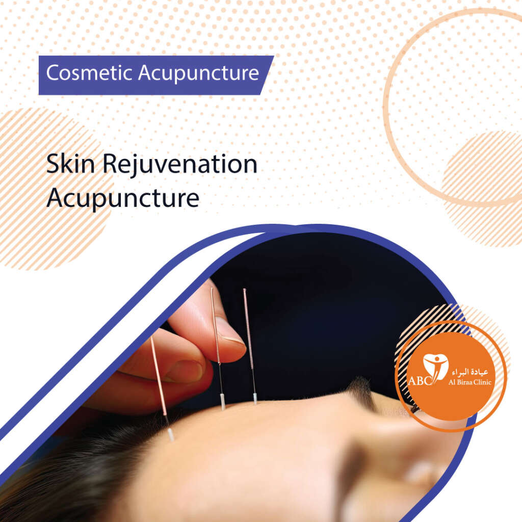 Skin-Rejuvenation-Acupuncture Clinic Dubai